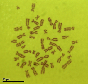 Human chromosomes magnified 2000 times.