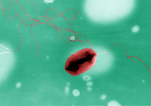 Bacterium (E. coli) with flagella.