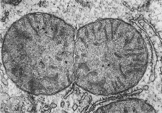 A mitochondrion in a cell from the liver of a rat prepares to divide.