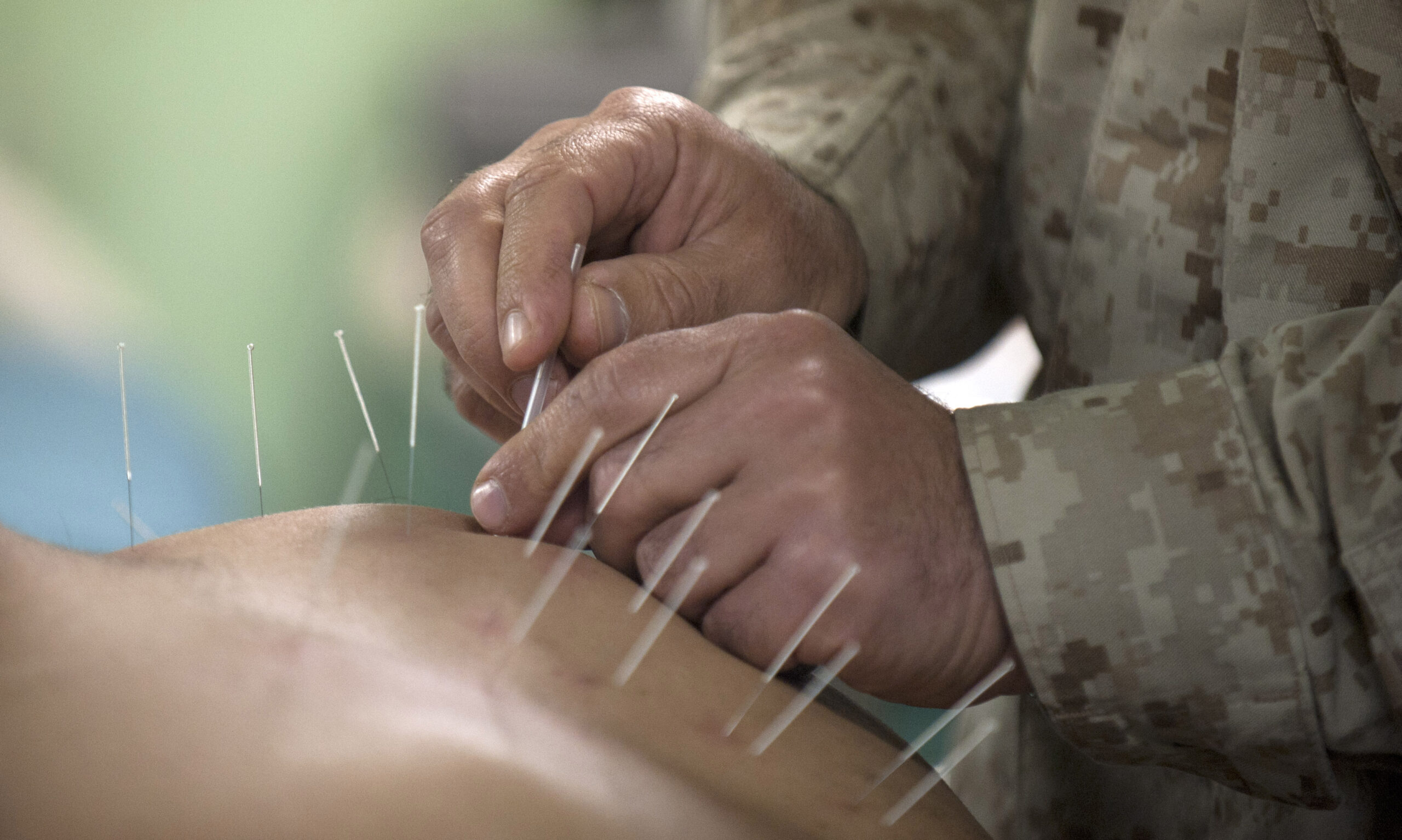person wearing army fatigues inserting acupuncture needles into someone's back